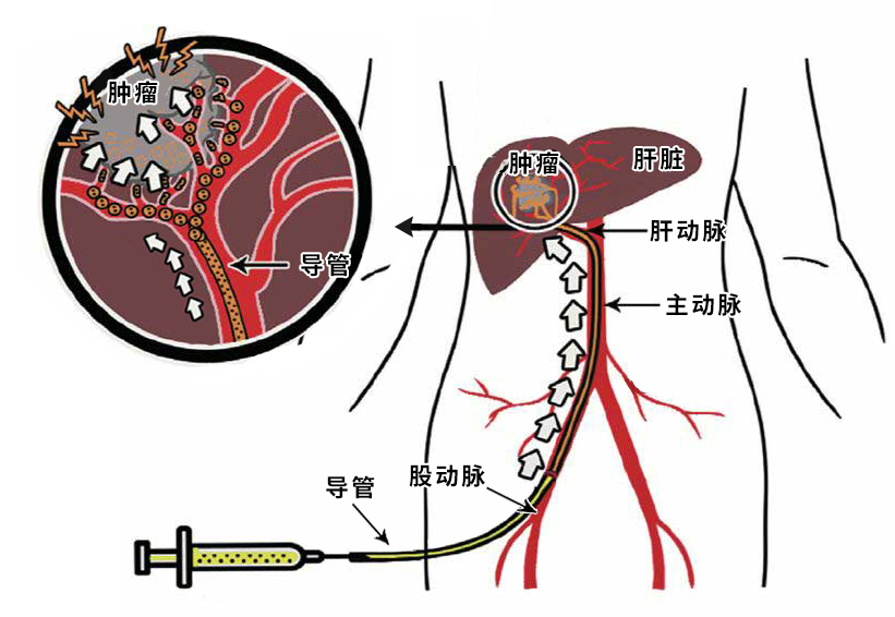 微信图片_20230330104553.png